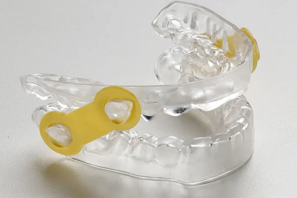 Invisalign Aligners in Madurai - Dentes Clinic