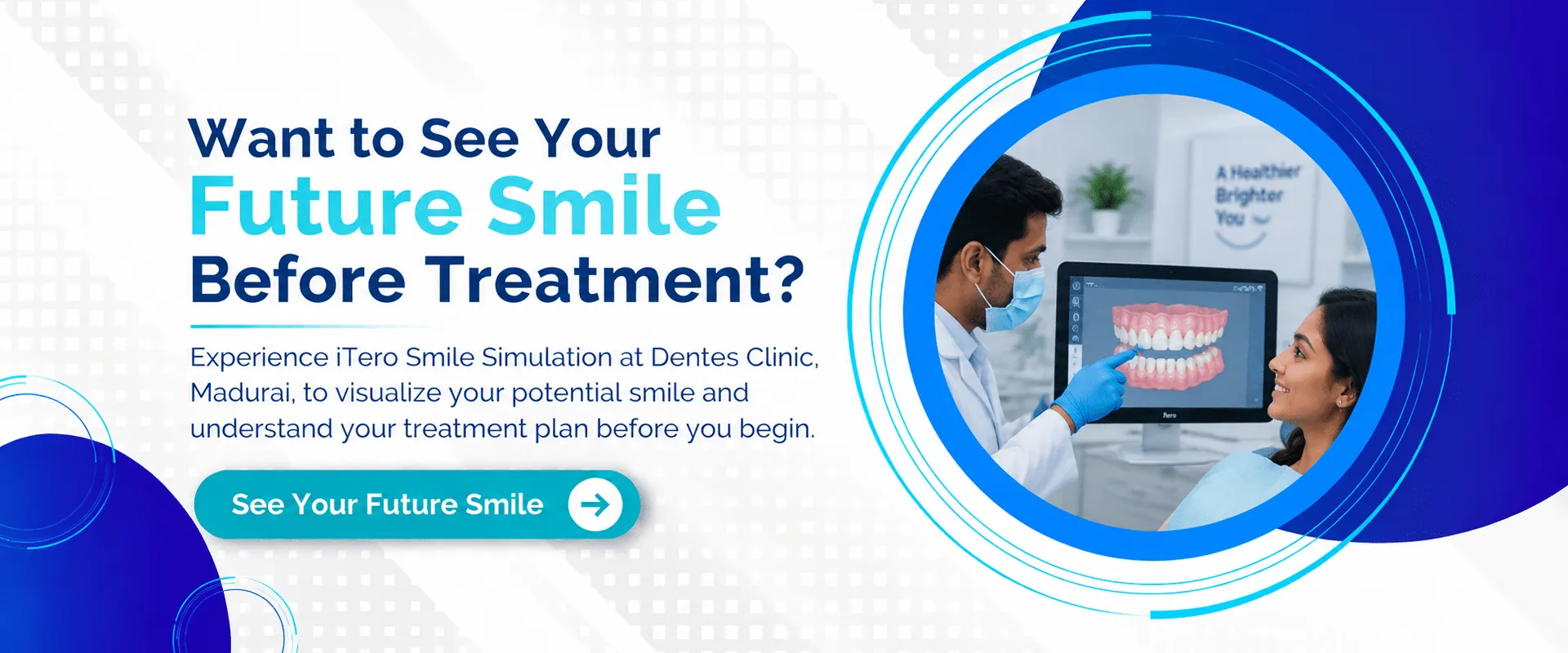 iTero Smile Simulation - See Your Future Smile