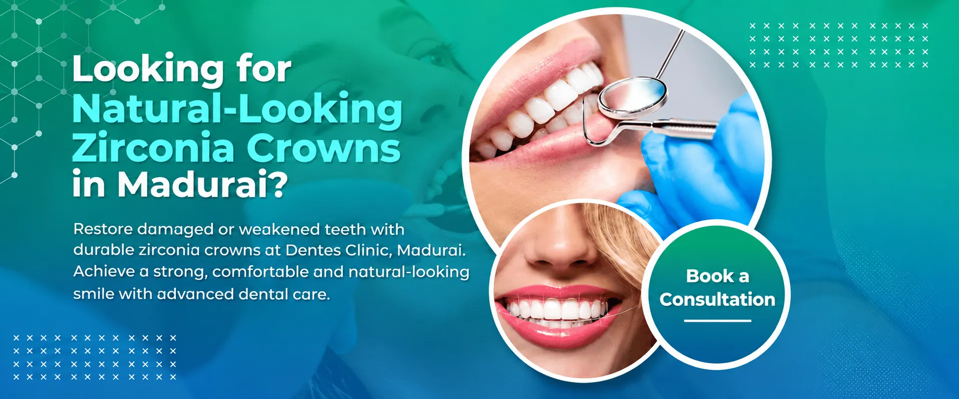 Natural-Looking Zirconia Crowns in Madurai