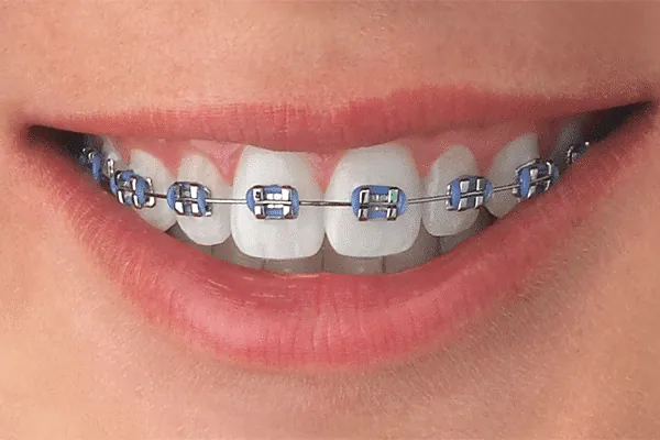 Best Dental Clinic in Madurai - Dentes Clinic
