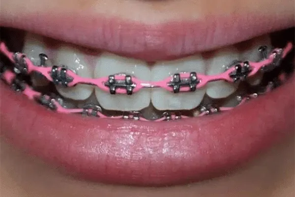 Dental Clinic in Madurai - Dentes Clinic