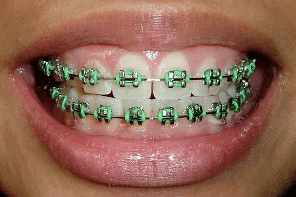 Best Dentist in Madurai - Dentes Clinic