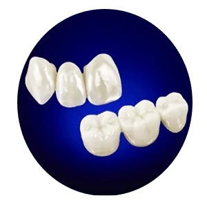 Best Dental Clinic in Madurai - Dentes Clinic