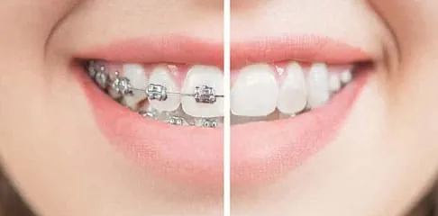 Best Dental Clinic in Madurai - Dentes Clinic