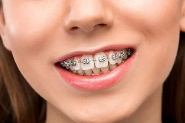 Dental Clinic in Madurai - Dentes Clinic