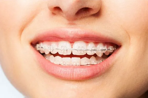 Dental Clinic in Madurai - Dentes Clinic