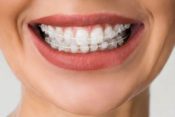 Best Dental Clinic in Madurai - Dentes Clinic