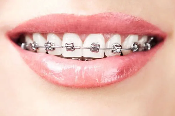 Best Dentist in Madurai - Dentes Clinic