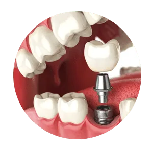 Digital planning for personalized smile enhancement