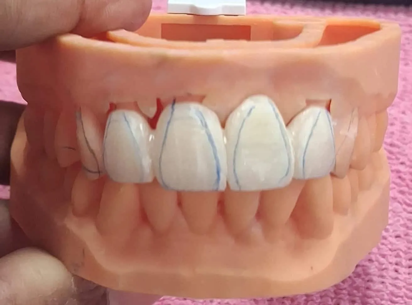 Dental Clinic in Madurai - Dentes Clinic