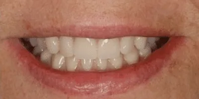 Best Dentist in Madurai - Dentes Clinic