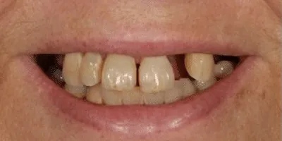 Best Dental Clinic in Madurai - Dentes Clinic