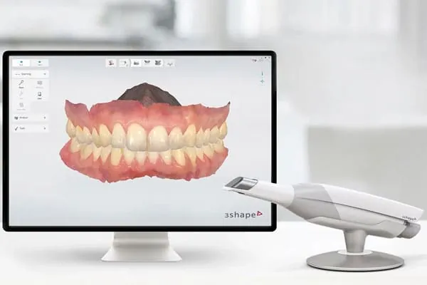 Dental Veneers in Madurai - Dentes Clinic
