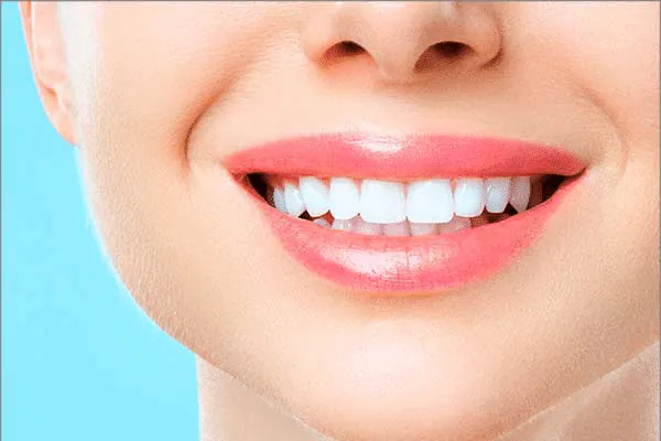 Remove Gaps in Teeth in Madurai - Dentes Clinic