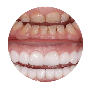 Trusted dental care and treatment in Madurai
