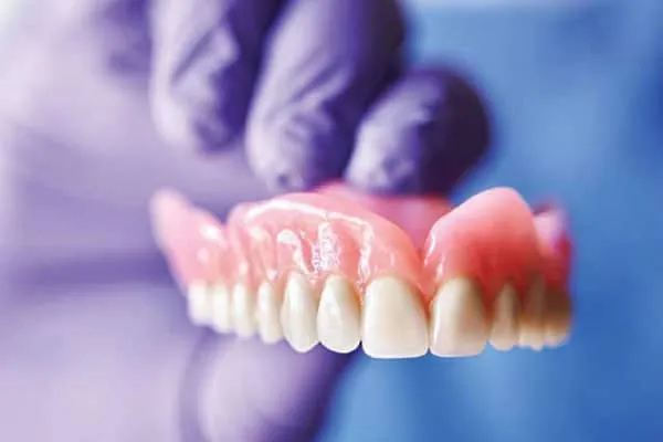 Ceramic Braces in Madurai - Dentes Clinic