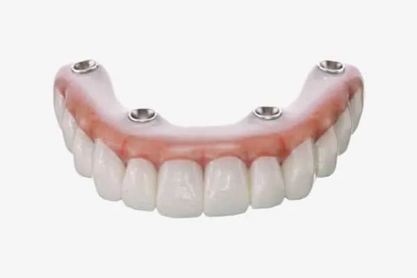 Digital Smile Design in Madurai - Dentes Clinic