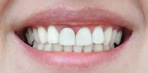 Best Dentist in Madurai - Dentes Clinic