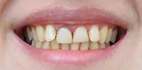 Best Dental Clinic in Madurai - Dentes Clinic