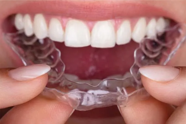 Best Dental Clinic in Madurai - Dentes Clinic