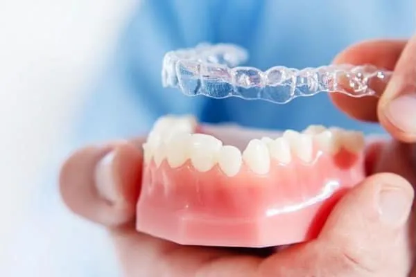 Teeth Whitening in Madurai - Dentes Clinic