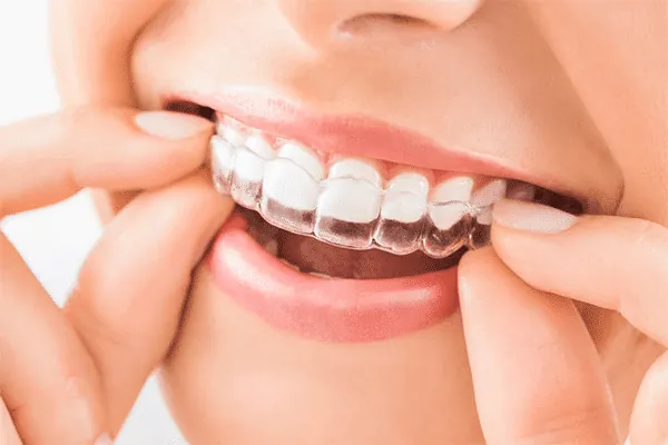 Top-rated dental care for complete oral treatment