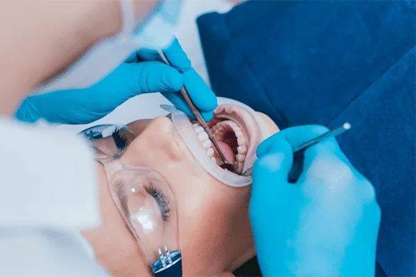 Clear removable aligners for correcting teeth alignment