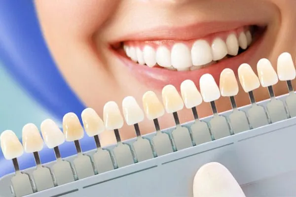 Dental Clinic in Madurai - Dentes Clinic