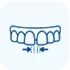 Smile Makeover in Madurai - Dentes Clinic