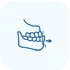 Dental Veneers in Madurai - Dentes Clinic