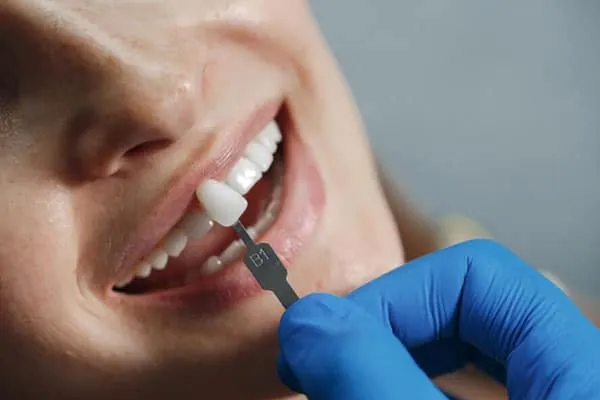 Best Dental Clinic in Madurai - Dentes Clinic