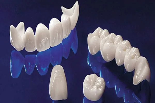 Best Invisalign Treatment in Madurai - Dentes Clinic