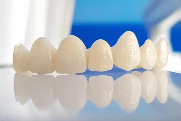 Dental Clinic in Madurai - Dentes Clinic