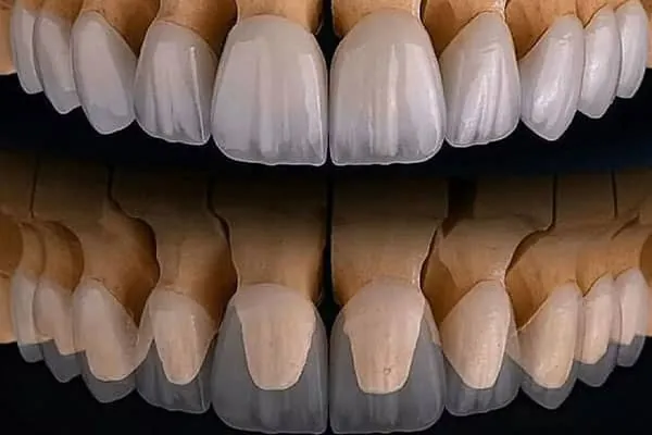 Best Dental Clinic in Madurai - Dentes Clinic
