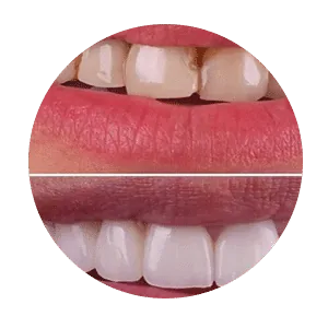 Best Dental Clinic in Madurai - Dentes Clinic