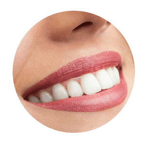 teeth-whitening-rounded